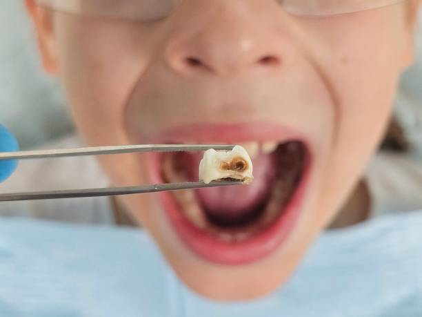 Best Weekend Emergency Dentist in Richlands, VA